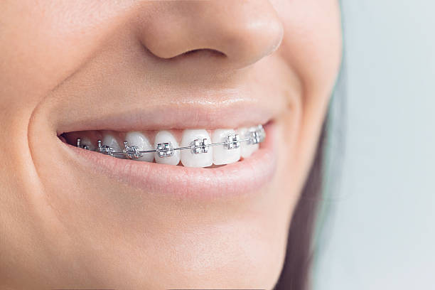 Best Invisalign and Clear Aligners  in La Croft, OH